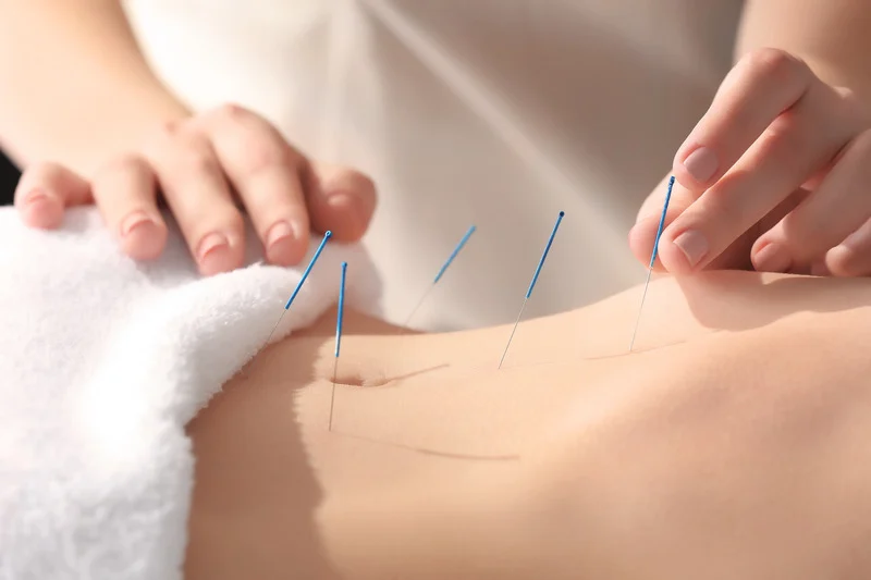 intramuscular-stimulation